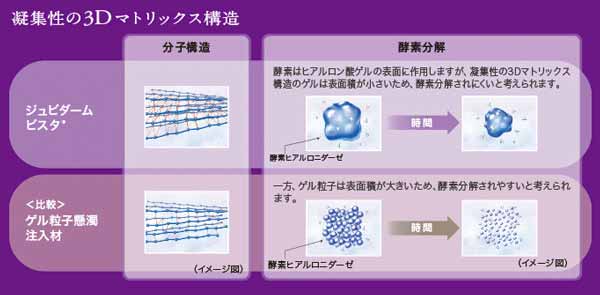 ３Dマトリックス　ヒアルロン酸ウルトラプラス