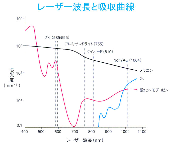 レーザー波長と吸収曲線と進達度