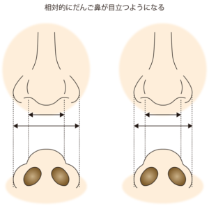 鼻翼縮小で鼻先が目立つイメージ