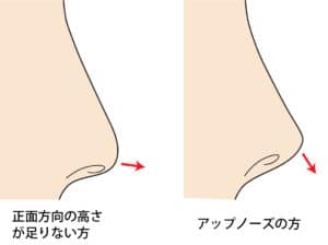 鼻先の高さが低いパターンのイメージ