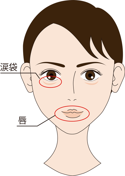 ヒアルロン酸（スタイレージS）の適した部位