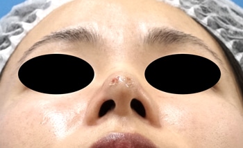 術直後の像部