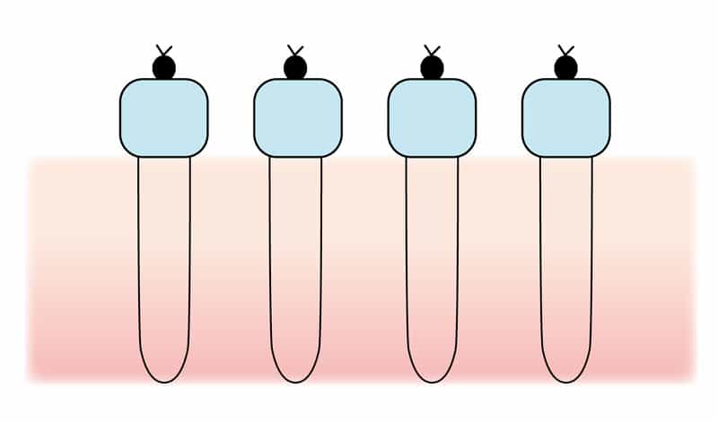 二重術（ビーズ法）の断面図イラスト