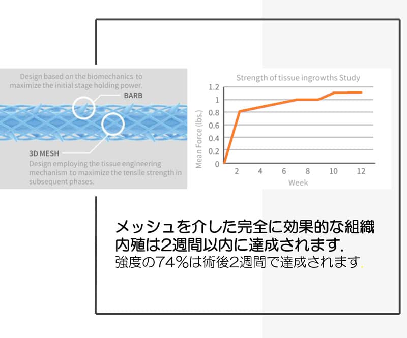 テスリフトの強度の経過