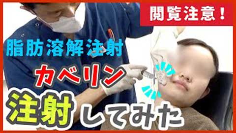 カベリン注入動画　サムネイル2