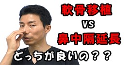 鼻尖軟骨移植と鼻中隔延長どっちが良い画像