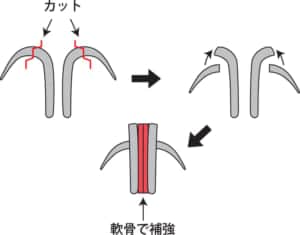 鼻尖縮小３D法のやり方のイラスト