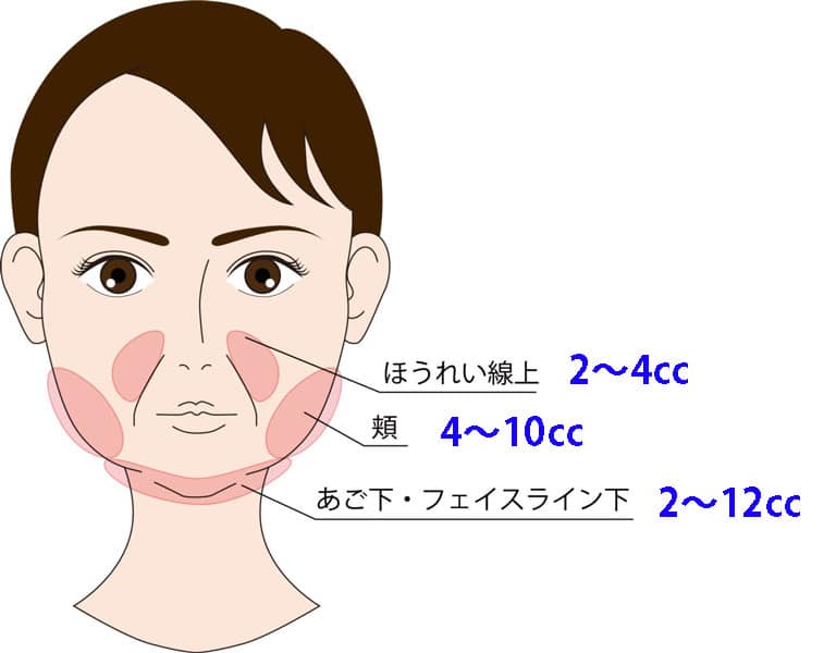 FatX顔の注入量目安