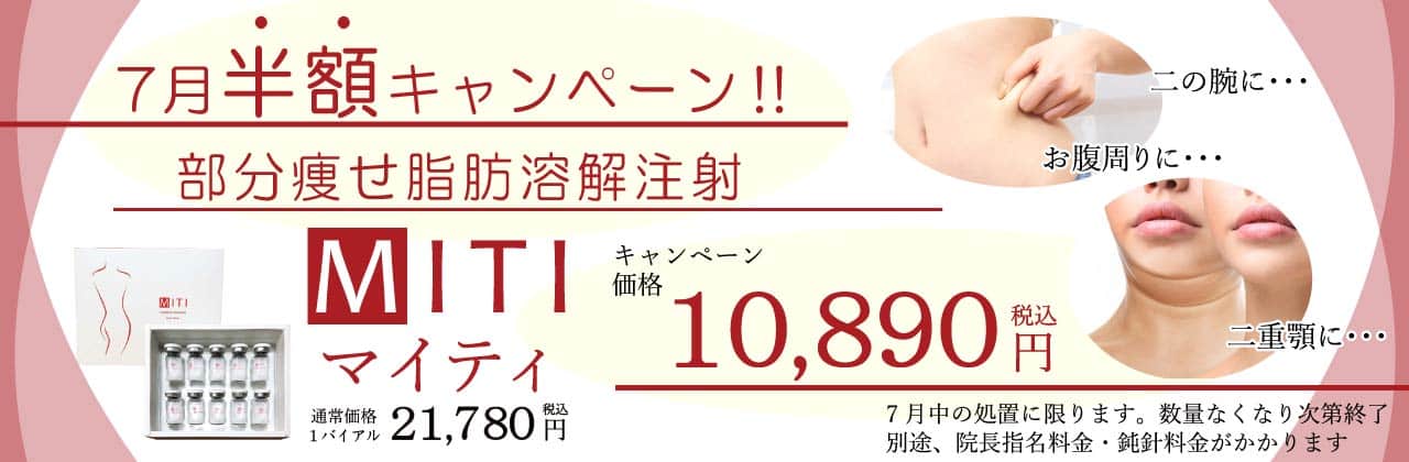 MITI　脂肪溶解注射　キャンペーン