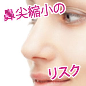 【鼻整形】失敗すると怖い！鼻尖縮小（団子鼻修正）のリスクをドクターが解説！