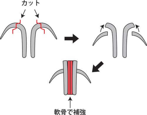 コラム　鼻尖縮小はアップノーズになるの？　図⑩3D法鼻翼軟骨形成のやり方