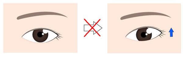 眉下切開は真ん中～外側の二重が広くなる　目尻が上がるわけではない