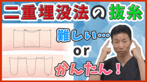 埋没法抜糸、難しい場合、簡
