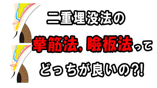 【二重埋没法】二重埋没法の挙筋法と瞼板法ってどっちが良いの？