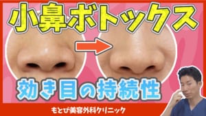 小鼻ボトックスの効果の持続性について