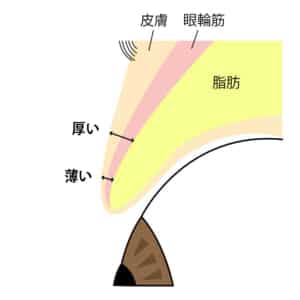まぶたは上に行くほど組織が厚くなる