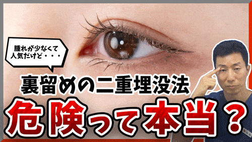 裏どめの二重埋没法の抜糸って難しいの？裏側からとらないといけない？