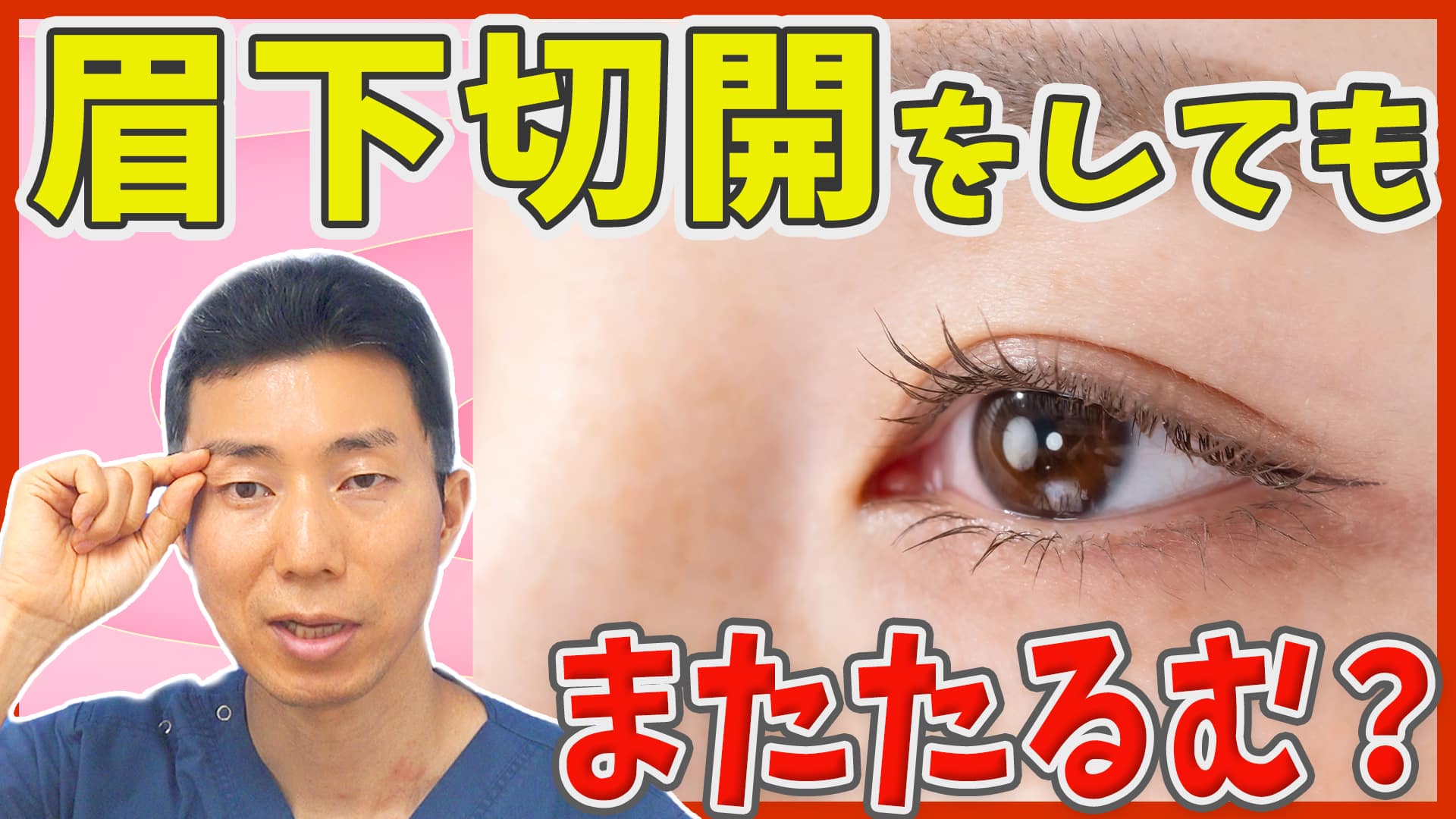 一度眉下切開をしても、またたるみが出てくることはありますか？