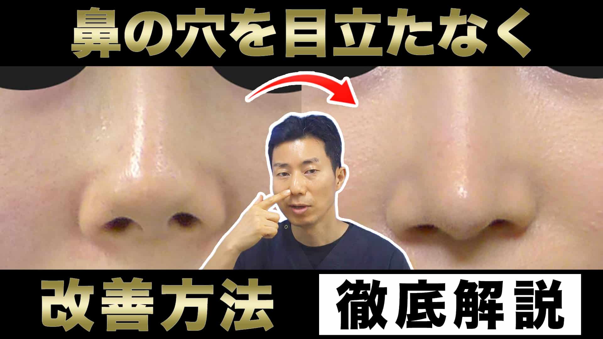 鼻の穴が目立たなくなる方法を解説