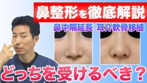 【鼻整形】鼻先の整形は鼻中隔延長と鼻尖形成のどちらを受けるべき？のイメージ画像