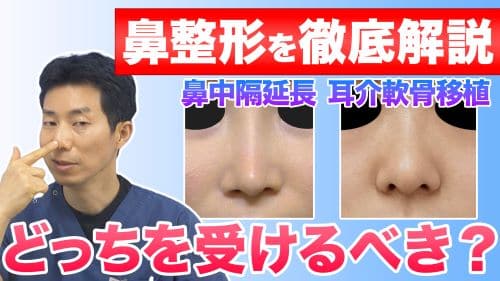 【鼻整形】鼻先の整形は鼻中隔延長と鼻尖形成のどちらを受けるべき？