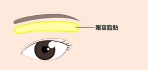 眼窩脂肪の厚みの部分