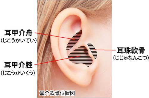 耳介軟骨移植はどこから軟骨を採取する？耳の傷は目立たない？　軟骨採取部分名称