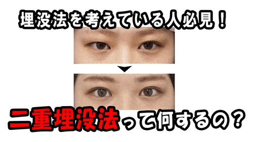 二重埋没法を考えている人必見！！二重埋没法について　