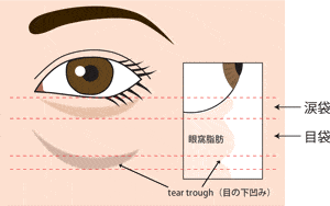 目袋について