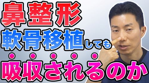 【鼻整形】軟骨移植しても吸収されるのか