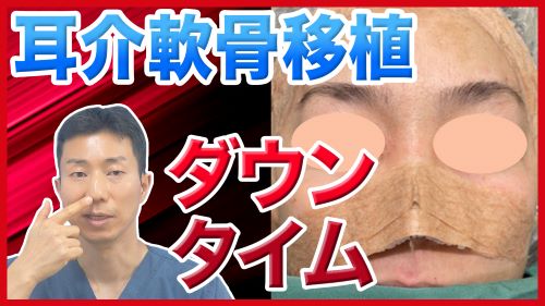耳介軟骨移植のギプス固定・ダウンタイムについて