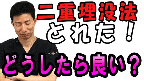 【二重埋没法】二重埋没法が取れてしまったらどうしたら良い？