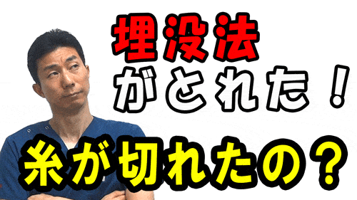 【二重埋没法】埋没法の二重が取れたんですけど、糸が切れてしまったの？
