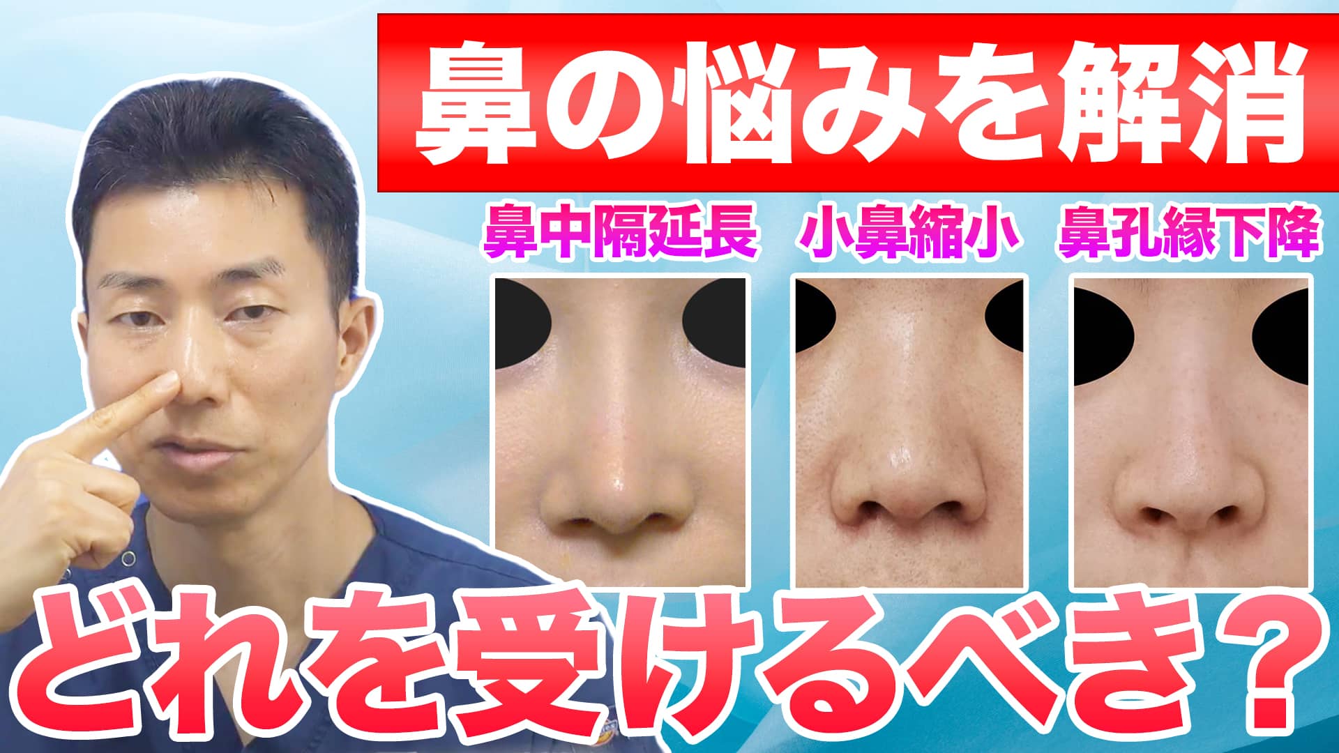 【鼻整形】鼻中隔延長と小鼻縮小と鼻孔縁下降を徹底比較｜自分はどれを受けるべき？