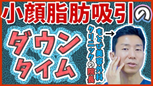 小顔脂肪吸引のダウンタイム　