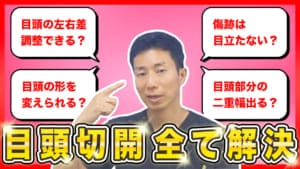 目頭切開に関してよくいただくご質問に回答します