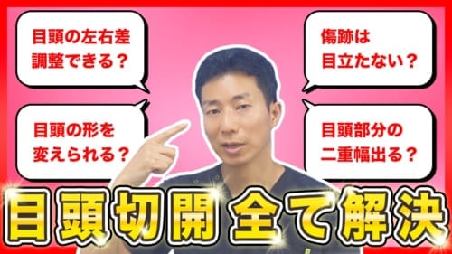 目頭切開に関して、よくご質問いただくことに対して回答・解説します　