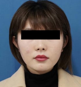 ⑧正面強力