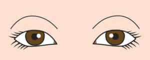 くぼみ目