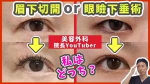 眉下切開と眼瞼下垂のどちらor両方を受けるべきか、それぞれの施術を症例写真で解説
