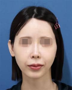 ホホ・貴族正面 1週間後