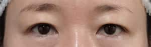 症例写真7 手術前