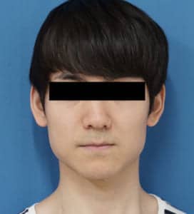 ⑨正面超強力