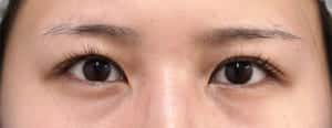 症例写真⑫2 手術前