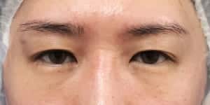 症例写真④ 手術前