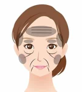 凹みや溝じわ