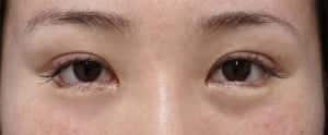 切らないたれ目直後
