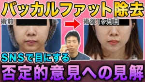 【小顔整形】バッカルファット除去やると後悔するって本当？効果と適応を徹底解説　縮小版