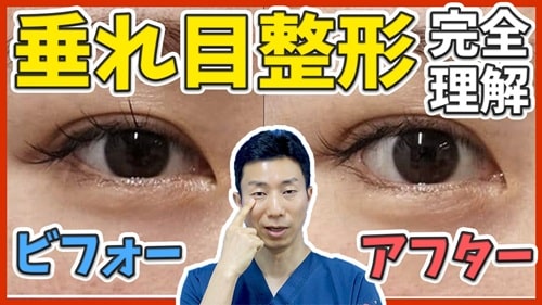 切らない垂れ目形成と切開する垂れ目形成