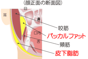 バッカルファット解剖